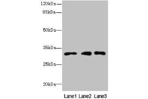 Western blot All lanes: PRDX4 antibody at 8 μg/mL Lane 1: HepG2 whole cell lysate Lane 2: Hela whole cell lysate Lane 3: 293T whole cell lysate Secondary Goat polyclonal to rabbit IgG at 1/10000 dilution Predicted band size: 31 kDa Observed band size: 31 kDa (Peroxiredoxin 4 Antikörper  (AA 38-271))
