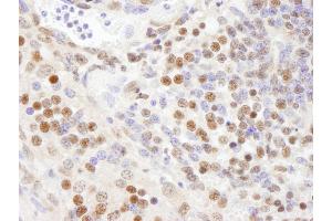 Immunohistochemistry (IHC) image for anti-Splicing Factor 3a, Subunit 1 (SF3A1) (AA 300-350) antibody (ABIN7449023) (SF3A1 Antikörper  (AA 300-350))