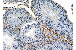 ABIN6258677 and ABIN6274898 at 1/100 staining Mouse testis tissue by IHC-P. (BNIP2 Antikörper  (Internal Region))