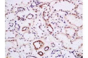 Formalin-fixed and paraffin embedded human kidney labeled with Anti-DTX3L Polyclonal Antibody, Unconjugated  at 1:200 followed by conjugation to the secondary antibody and DAB staining. (DTX3L Antikörper  (AA 651-740))