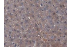 IHC-P analysis of Rat Liver Tissue, with DAB staining. (SHBG Antikörper)