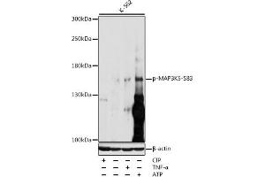 Western blot analysis of extracts of various cell lines, using Phospho-MK5-S83 antibody (ABIN3019487, ABIN3019488, ABIN3019489 and ABIN6225424) at 1:1000 dilution. (ASK1 Antikörper  (pSer83))