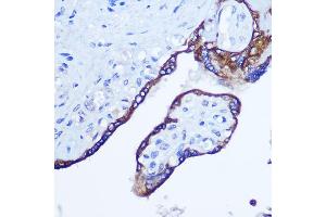 Immunohistochemistry of paraffin-embedded human placenta using RhoA Rabbit pAb (ABIN3020848, ABIN3020849, ABIN3020850 and ABIN6213755) at dilution of 1:100 (40x lens). (RHOA Antikörper  (C-Term))
