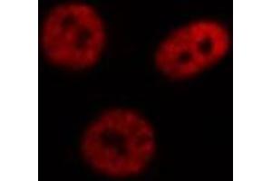 ABIN6269111 staining Hep G2 cells by IF/ICC. (HNRNPC Antikörper  (C-Term))