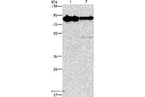 Western blot analysis of Mouse brain and human brain malignant glioma tissue, using KIF3A Polyclonal Antibody at dilution of 1:750 (KIF3A Antikörper)