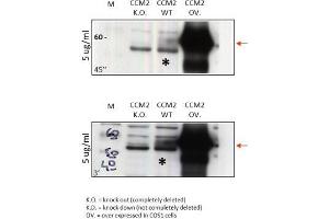 Western Blot Analysis of anti-human CCM-2. (CCM2 Antikörper  (N-Term))