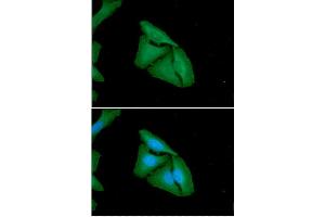 ICC/IF analysis of FHL2 in HeLa cells.
