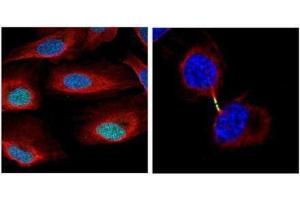ICC/IF Image Confocal immunofluorescence analysis (Olympus FV10i) of paraformaldehyde-fixed U2OS, using Survivin, antibody (Geen) at 1:500 dilution. (Survivin Antikörper)