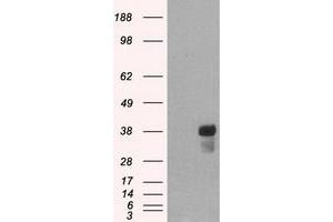 HEK293T cells were transfected with the pCMV6-ENTRY control (Left lane) or pCMV6-ENTRY CD2 (Right lane) cDNA for 48 hrs and lysed. (CD2 Antikörper)