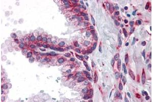 Human Prostate: Formalin-Fixed, Paraffin-Embedded (FFPE) (MTDH Antikörper)
