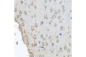 Immunohistochemistry of paraffin-embedded mouse brain using HBA2 antibody at dilution of 1:100 (x40 lens). (HBa2 Antikörper)