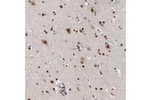Immunohistochemical staining of human cerebral cortex with ZNF777 polyclonal antibody  shows strong nuclear positivity in neuronal and glial cells. (ZNF777 Antikörper)