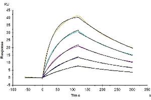 Surface Plasmon Resonance (SPR) image for Interleukin 4 Receptor (IL4R) (AA 26-232) protein (His tag) (ABIN7274989)