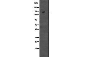 Western blot analysis of CCAR1 expression in Hela cell lysate,The lane on the left is treated with the antigen-specific peptide. (CCAR1 Antikörper  (Internal Region))