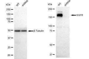 Western blotting analysis using EGFR antibody (ABIN7798461).