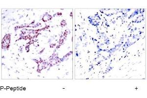 Image no. 1 for anti-Signal Transducer and Activator of Transcription 1, 91kDa (STAT1) (pTyr701) antibody (ABIN196688) (STAT1 Antikörper  (pTyr701))