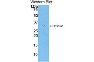 Detection of Recombinant gSAP, Human using Polyclonal Antibody to Gamma-Secretase Activating Protein (gSAP) (GSAP Antikörper  (AA 616-854))