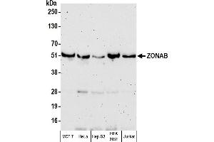 anti-Y Box Binding Protein 3 (YBX3) (AA 250-300) antibody