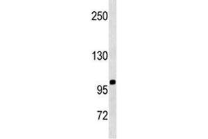 CD43 antibody western blot analysis in SK-BR-3 lysate.