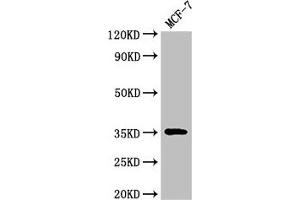 Western Blot Positive WB detected in: MCF-7 whole cell lysate All lanes: ACY3 antibody at 3 μg/mL Secondary Goat polyclonal to rabbit IgG at 1/50000 dilution Predicted band size: 36 kDa Observed band size: 36 kDa (Aminoacylase 3 Antikörper  (AA 5-319))