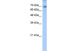 WB Suggested Anti-LNX1 Antibody Titration:  1. (LNX1 Antikörper  (C-Term))