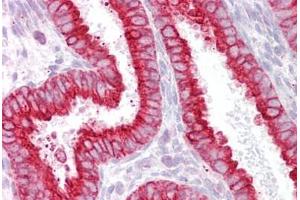 Anti-CHRNB4 antibody IHC staining of human uterus.