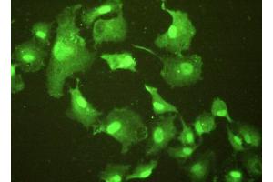 Immunohistochemistry (IHC) image for anti-Epithelial Cell Transforming Sequence 2 Oncogene (ECT2) (AA 166-348) antibody (ABIN1175693)