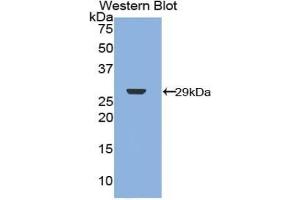 Detection of Recombinant NF2, Human using Polyclonal Antibody to Neurofibromin 2 (NF2)