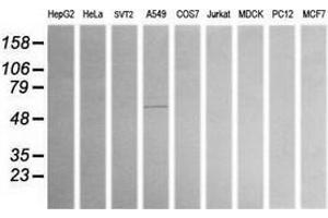 Western Blotting (WB) image for anti-Aldehyde Dehydrogenase 1 Family, Member A3 (ALDH1A3) (AA 1-100), (AA 413-512) antibody (ABIN2715887) (ALDH1A3 Antikörper  (AA 1-100, AA 413-512))