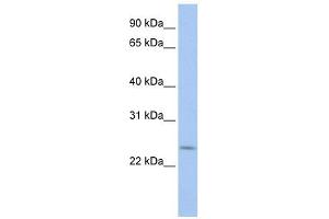 PRELID2 antibody used at 1 ug/ml to detect target protein.