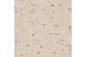 Immunohistochemistry (IHC) image for anti-Hydroxysteroid (17-Beta) Dehydrogenase 2 (HSD17B2) antibody (ABIN1873085) (HSD17B2 Antikörper)
