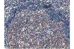 Immunohistochemical staining of paraffin-embedded Human lymph node tissue using anti-CBWD1 mouse monoclonal antibody. (CBWD1 Antikörper)