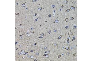 Immunohistochemistry of paraffin-embedded rat brain using HMMR antibody (ABIN5971368) at dilution of 1/100 (40x lens). (HMMR Antikörper)