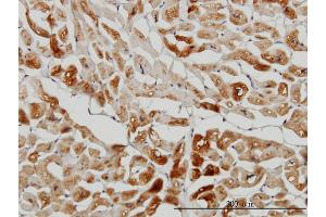 Immunoperoxidase of monoclonal antibody to HSPB7 on formalin-fixed paraffin-embedded human heart.