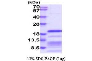 SDS-PAGE (SDS) image for Relaxin 2 (RLN2) (AA 25-185) protein (His tag) (ABIN6387989) (Relaxin 2 Protein (RLN2) (AA 25-185) (His tag))