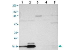 Western blot analysis of Lane 1: RT-4, Lane 2: U-251 MG, Lane 3: Human Plasma, Lane 4: Liver, Lane 5: Tonsil with RPL27 polyclonal antibody . (RPL27 Antikörper)