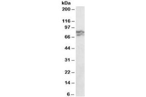 Western blot testing of HeLa lysate with RPA70 antibody at 0. (RPA1 Antikörper)