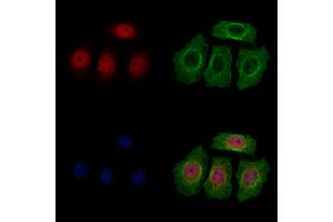 ABIN7094464 and ABIN7098512 staining HepG2 cells by IF/ICC. (Thymopoietin Antikörper  (Internal Region))