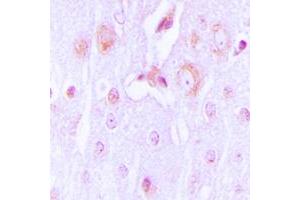 Immunohistochemical analysis of Tyrosine Hydroxylase staining in human brain formalin fixed paraffin embedded tissue section. (Tyrosine Hydroxylase Antikörper  (N-Term))