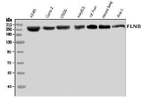Western blot analysis of Filamin B/FLNB using anti-Filamin B/FLNB antibody (ABIN7601607).