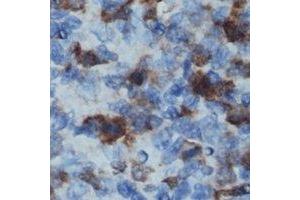 Immunohistochemical analysis of CD32b staining in human lymph node formalin fixed paraffin embedded tissue section. (FCGR2B Antikörper  (C-Term))