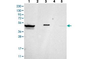 Western blot analysis of Lane 1: RT-4, Lane 2: U-251 MG, Lane 3: Human Plasma, Lane 4: Liver, Lane 5: Tonsil with ZNF774 polyclonal antibody . (ZNF774 Antikörper)