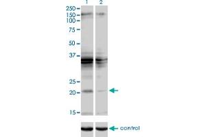 Western blot analysis of SCAND2 over-expressed 293 cell line, cotransfected with SCAND2 Validated Chimera RNAi (Lane 2) or non-transfected control (Lane 1). (SCAND2 Antikörper  (AA 1-62))
