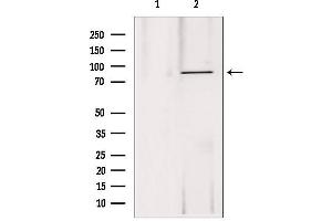 Western blot analysis of extracts from 293, using DDX21 antibody. (DDX21 Antikörper  (Internal Region))