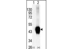 Western blot analysis of BCKDK (arrow) using rabbit polyclonal BCKDK Antibody (C-term ) (R). (BCKDK Antikörper  (C-Term))