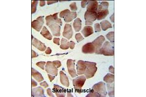 PATL1 Antibody IHC analysis in formalin fixed and paraffin embedded skeletal muscle followed by peroxidase conjugation of the secondary antibody and DAB staining. (PATL1 Antikörper  (C-Term))