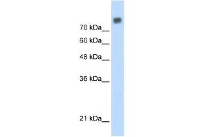 WB Suggested Anti-MCM6 Antibody Titration:  0. (MCM6 Antikörper  (C-Term))