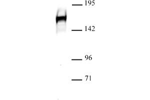 Drosha antibody (pAb) tested by Western blot. (DROSHA Antikörper  (C-Term))