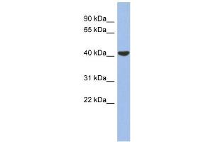 GJD4 antibody used at 1 ug/ml to detect target protein. (GJD4 Antikörper  (Middle Region))