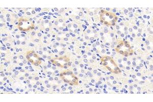 Detection of CTTN in Rat Kidney Tissue using Polyclonal Antibody to Cortactin (CTTN) (Cortactin Antikörper  (AA 1-509))